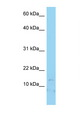 LAMA4 / Laminin Alpha 4 Antibody - LAMA4 antibody Western blot of Jurkat Cell lysate. Antibody concentration 1 ug/ml.  This image was taken for the unconjugated form of this product. Other forms have not been tested.