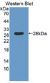 LAMB4 / Laminin Beta 4 Antibody - Western blot of LAMB4 / Laminin Beta 4 antibody.