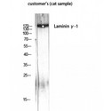 LAMC1 / Laminin Gamma 1 Antibody - Western blot of Laminin gamma-1 antibody
