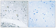LAMC3 / Laminin Gamma 3 Antibody - Immunohistochemistry analysis of paraffin-embedded human brain tissue, using LAMC3 Antibody. The picture on the right is blocked with the synthesized peptide.