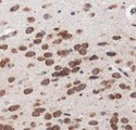 LAMTOR3 / MP1 Antibody - Immunohistochemistry: MAP2K1IP1/MAPKSP1 Antibody - IHC of MAP2K1IP1 in mouse lung.  This image was taken for the unconjugated form of this product. Other forms have not been tested.