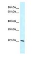 LAPTM4B Antibody - LAPTM4B antibody Western Blot of NIH-3T3.  This image was taken for the unconjugated form of this product. Other forms have not been tested.