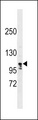 LARP1B Antibody - LARP1B Antibody western blot of ZR-75-1 cell line lysates (35 ug/lane). The LARP1B antibody detected the LARP1B protein (arrow).