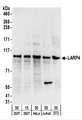 LARP4 Antibody - Detection of Human and Mouse LARP4 by Western Blot. Samples: Whole cell lysate from 293T (15 and 50 ug), HeLa (50 ug), Jurkat (50 ug), and mouse NIH3T3 (50 ug) cells. Antibodies: Affinity purified rabbit anti-LARP4 antibody used for WB at 0.4 ug/ml. Detection: Chemiluminescence with an exposure time of 30 seconds.