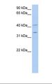 LASP1 Antibody - MCF7 cell lysate. Antibody concentration: 1.0 ug/ml. Gel concentration: 12%.  This image was taken for the unconjugated form of this product. Other forms have not been tested.