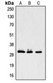 LASP1 Antibody - Western blot analysis of LASP1 expression in A431 (A); MCF7 (B); mouse brain (C) whole cell lysates.