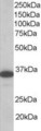 LAT Antibody - Staining (1 ug/ml) of Human PBMC lysate (RIPA buffer, 35 ug total protein per lane). Primary incubated for 1 hour. Detected using chemiluminescence.
