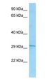 Latexin / MUM Antibody - Latexin / MUM antibody Western Blot of A549 cell lysate. LXN is supported by BioGPS gene expression data to be expressed in A549.  This image was taken for the unconjugated form of this product. Other forms have not been tested.