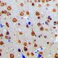 LBC / AKAP13 Antibody - Immunohistochemical analysis of AKAP13 staining in human brain formalin fixed paraffin embedded tissue section. The section was pre-treated using heat mediated antigen retrieval with sodium citrate buffer (pH 6.0). The section was then incubated with the antibody at room temperature and detected using an HRP conjugated compact polymer system. DAB was used as the chromogen. The section was then counterstained with hematoxylin and mounted with DPX.