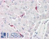 LBP Antibody - Anti-LBP antibody IHC of human liver. Immunohistochemistry of formalin-fixed, paraffin-embedded tissue after heat-induced antigen retrieval. Antibody dilution 2.5-5 ug/ml. This image was taken for the unconjugated form of this product. Other forms have not been tested.