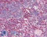 LBR / Lamin B Receptor Antibody - Anti-LBR / Lamin B Receptor antibody IHC of human thymus. Immunohistochemistry of formalin-fixed, paraffin-embedded tissue after heat-induced antigen retrieval. Antibody dilution 5-10 ug/ml. This image was taken for the unconjugated form of this product. Other forms have not been tested.