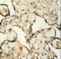 LCA5L Antibody - LCA5L antibody immunohistochemistry of formalin-fixed and paraffin-embedded human placenta tissue followed by peroxidase-conjugated secondary antibody and DAB staining.