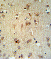 LCAT Antibody - LCAT Antibody IHC of formalin-fixed and paraffin-embedded brain tissue followed by peroxidase-conjugated secondary antibody and DAB staining.