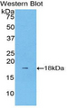 LCAT Antibody - Western blot of recombinant LCAT.  This image was taken for the unconjugated form of this product. Other forms have not been tested.