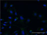 LCAT Antibody - Immunofluorescence of monoclonal antibody to LCAT on HeLa cell . [antibody concentration 10 ug/ml]