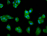 LCE3C Antibody - Immunofluorescence staining of HepG2 cells diluted at 1:33, counter-stained with DAPI. The cells were fixed in 4% formaldehyde, permeabilized using 0.2% Triton X-100 and blocked in 10% normal Goat Serum. The cells were then incubated with the antibody overnight at 4°C.The Secondary antibody was Alexa Fluor 488-congugated AffiniPure Goat Anti-Rabbit IgG (H+L).