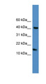 LCN1 / Lipocalin-1 Antibody - LCN1 antibody Western blot of Jurkat lysate. This image was taken for the unconjugated form of this product. Other forms have not been tested.