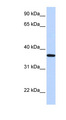 LCN12 Antibody - LCN12 antibody Western blot of Fetal Heart lysate. This image was taken for the unconjugated form of this product. Other forms have not been tested.