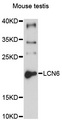LCN6 Antibody - Western blot analysis of extracts of mouse testis, using LCN6 antibody at 1:1000 dilution. The secondary antibody used was an HRP Goat Anti-Rabbit IgG (H+L) at 1:10000 dilution. Lysates were loaded 25ug per lane and 3% nonfat dry milk in TBST was used for blocking. An ECL Kit was used for detection and the exposure time was 5s.