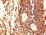 LCP1 / L-Plastin Antibody - IHC image of LCP1 Antibody diluted at 1:400 and staining in paraffin-embedded human spleen tissue performed on a Leica BondTM system. After dewaxing and hydration, antigen retrieval was mediated by high pressure in a citrate buffer (pH 6.0). Section was blocked with 10% normal goat serum 30min at RT. Then primary antibody (1% BSA) was incubated at 4°C overnight. The primary is detected by a biotinylated secondary antibody and visualized using an HRP conjugated SP system.