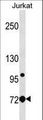 LCP1 / L-Plastin Antibody - LCP1 Antibody western blot of Jurkat cell line lysates (35 ug/lane). The LCP1 antibody detected the LCP1 protein (arrow).