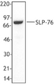 LCP2 / SLP-76 Antibody - MOLT4 total lysate (1% NP40) was resolved by electrophoresis, transferred to nitrocellulose and probed with monoclonal anti-SLP76 antibody. Proteins were visualized using a goat anti-mouse secondary conjugated to HRP and a chemiluminescence detection system.