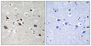 LCP2 / SLP-76 Antibody - Immunohistochemistry analysis of paraffin-embedded human brain, using SLP-76 (Phospho-Tyr128) Antibody. The picture on the right is blocked with the phospho peptide.