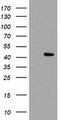 LDAH Antibody - HEK293T cells were transfected with the pCMV6-ENTRY control (Left lane) or pCMV6-ENTRY C2orf43 (Right lane) cDNA for 48 hrs and lysed. Equivalent amounts of cell lysates (5 ug per lane) were separated by SDS-PAGE and immunoblotted with anti-C2orf43.