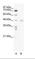 LDB1 / CLIM2 Antibody - A: Marker, B: Jurkat Cell Lysate.  This image was taken for the unconjugated form of this product. Other forms have not been tested.