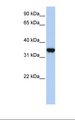 LDHA / LDH1 Antibody - 293T cell lysate. Antibody concentration: 1.0 ug/ml. Gel concentration: 12%.  This image was taken for the unconjugated form of this product. Other forms have not been tested.