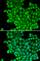 LDHA / LDH1 Antibody - Immunofluorescence analysis of A549 cells using LDHA antibody. Blue: DAPI for nuclear staining.