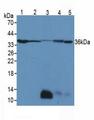 LDHB / Lactate Dehydrogenase B Antibody - Western Blot; Sample. Lane1: Human Jurkat Cells; Lane2: Human A431 Cells; Lane3: Mouse Testis Tissue; Lane4: Mouse Kidney Tissue; Lane5: Human Liver Tissue.