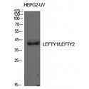 LEFTY1+2 Antibody - Western blot of Lefty antibody