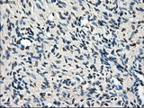 LEMD3 / MAN1 Antibody - Immunohistochemical staining of paraffin-embedded Ovary tissue using anti-LEMD3 mouse monoclonal antibody. (Dilution 1:50).