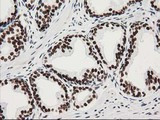 LENG1 Antibody - IHC of paraffin-embedded Human prostate tissue using anti-LENG1 mouse monoclonal antibody.