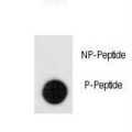 LEO1 Antibody - Dot blot of anti-Phospho-Leo1-pS551 Antibody on nitrocellulose membrane. 50ng of Phospho-peptide or Non Phospho-peptide per dot were adsorbed. Antibody working concentrations are 0.5ug per ml.
