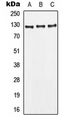 LEPR / Leptin Receptor Antibody - Western blot analysis of CD295 expression in MCF7 (A); HepG2 (B); HeLa (C) whole cell lysates.