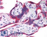 Leptin Antibody - Anti-LEP / Leptin antibody IHC of human placenta. Immunohistochemistry of formalin-fixed, paraffin-embedded tissue after heat-induced antigen retrieval. Antibody concentration 5 ug/ml.  This image was taken for the unconjugated form of this product. Other forms have not been tested.