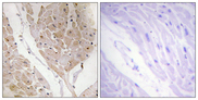LGALS2 / Galectin 2 Antibody - Immunohistochemistry analysis of paraffin-embedded human heart tissue, using LEG2 Antibody. The picture on the right is blocked with the synthesized peptide.