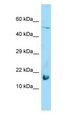 LGALS7 / Galectin 7 Antibody - GAL7 / Galectin 7 antibody Western Blot of HepG2.  This image was taken for the unconjugated form of this product. Other forms have not been tested.
