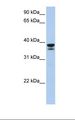 LGALS9 / Galectin 9 Antibody - Fetal muscle lysate. Antibody concentration: 1.0 ug/ml. Gel concentration: 12%.  This image was taken for the unconjugated form of this product. Other forms have not been tested.