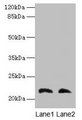 LGALS9C Antibody - Western blot All lanes: LGALS9C antibody at 4µg/ml Lane 1: Mouse stomach tissue Lane 2: Mouse liver tissue Secondary Goat polyclonal to rabbit IgG at 1/10000 dilution Predicted band size: 22 kDa Observed band size: 22 kDa