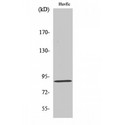 LGR6 Antibody - Western blot of LGR6 antibody