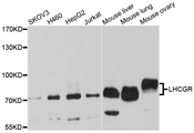 LHCGR / LHR / LH Receptor Antibody - Western blot analysis of extracts of various cell lines.