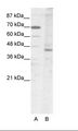 LHX2 Antibody - A: Marker, B: HepG2 Cell Lysate.  This image was taken for the unconjugated form of this product. Other forms have not been tested.
