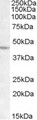 LHX2 Antibody - Antibody (1 ug/ml) staining of DAUDI lysate (35 ug protein in RIPA buffer). Primary incubation was 1 hour. Detected by chemiluminescence.