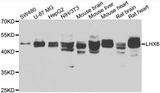 LHX6 Antibody - Western blot analysis of extracts of various cell lines.