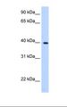 LIAS / LIP1 Antibody - LN 18 cell lysate. Antibody concentration: 0.25 ug/ml. Gel concentration: 12%.  This image was taken for the unconjugated form of this product. Other forms have not been tested.