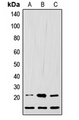 LIF Antibody - Western blot analysis of LIF expression in HEK293T (A); Raw264.7 (B); H9C2 (C) whole cell lysates.