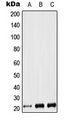 LIF Antibody - Western blot analysis of LIF expression in Jurkat (A); NIH3T3 (B); PC12 (C) whole cell lysates.